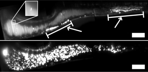 Aeromonas_two_images