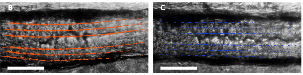 DIC_gut_T6SS_bar50um_horiz