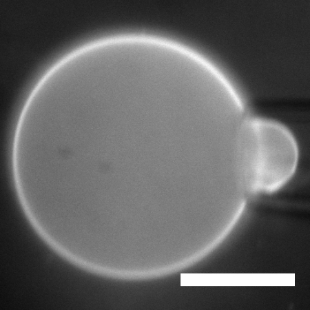 From_24July2017_Vesicle8_Frame6_bar20um