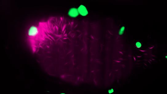 Bacteria and immune response